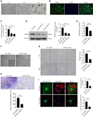 Chaperonin-Containing TCP1 Subunit 5 Protects Against the Effect of Mer Receptor Tyrosine Kinase Knockdown in Retinal Pigment Epithelial Cells by Interacting With Filamentous Actin and Activating the LIM-Kinase 1/Cofilin Pathway